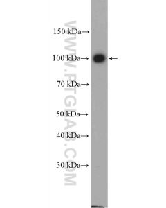 Adaptin Polyclonal antibody 10130-1-AP proteintech