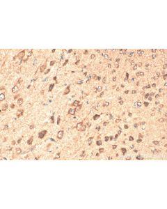 SNX17 Polyclonal antibody 10275-1-AP proteintech