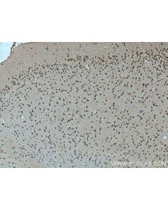 Cirhin Polyclonal antibody 11057-1-AP proteintech
