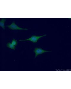 Oligophrenin 1 Polyclonal antibody 11076-1-AP proteintech