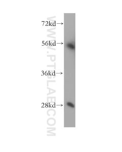 SUV39H2 Polyclonal antibody 11338-1-AP proteintech