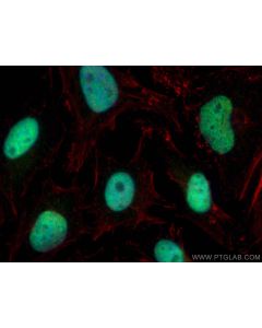 ZBTB7B Polyclonal antibody 11341-1-AP proteintech
