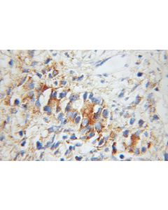 UBE2D1/2/3/4 Polyclonal antibody 11373-1-AP proteintech