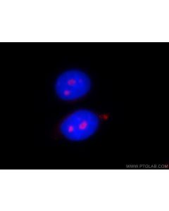 PWP2 Polyclonal antibody 11390-1-AP proteintech