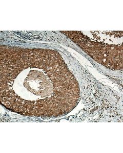 SURF4 Polyclonal antibody 11599-1-AP proteintech