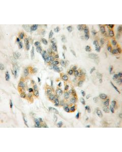 LRR 1 Polyclonal antibody 11628-1-AP proteintech
