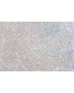 AP4M1 Polyclonal antibody 11653-1-AP proteintech