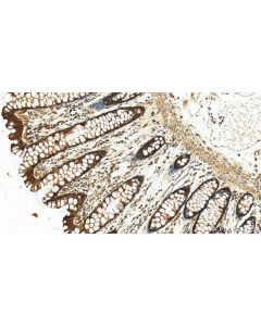 VDAC1/2/3 Polyclonal antibody 11663-1-AP proteintech