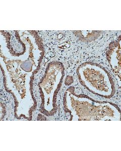 UBE2D1/2/3/4 Polyclonal antibody 11677-1-AP proteintech