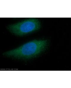 GNGT1 Polyclonal antibody 11884-1-AP proteintech