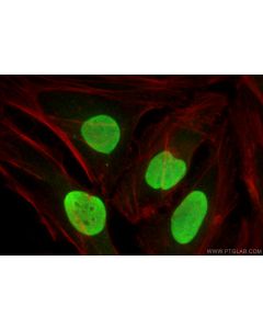 SUB1 Polyclonal antibody 11956-1-AP proteintech