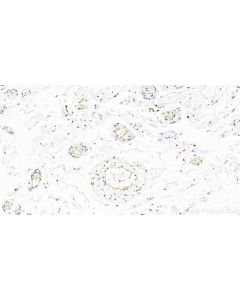 EXOSC8 Polyclonal antibody 11979-1-AP proteintech