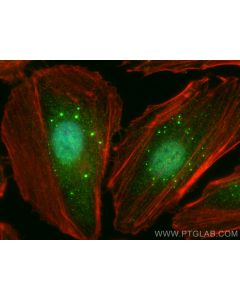 CNBP Polyclonal antibody 12103-1-AP proteintech