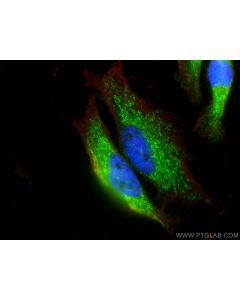 AP3M1 Polyclonal antibody 12114-1-AP proteintech