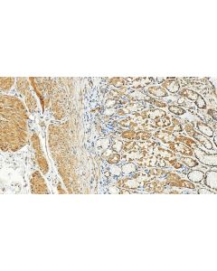 UBE3C Polyclonal antibody 12333-1-AP proteintech
