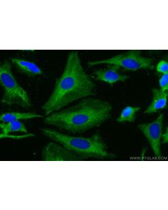CD46 Polyclonal antibody 12494-1-AP proteintech