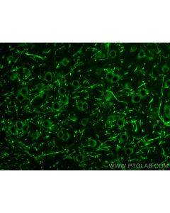 SLC20A2 Polyclonal antibody 12820-1-AP proteintech