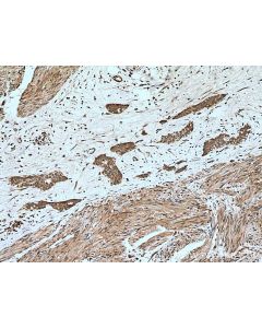 PPM1A Polyclonal antibody 12961-1-AP proteintech