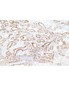 NKX3-1 Polyclonal antibody 13069-1-AP proteintech