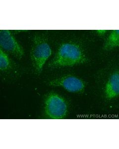 FGD1 Polyclonal antibody 13141-1-AP proteintech