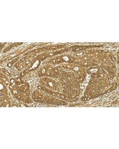 COX-1/Cyclooxygenase-1 Polyclonal antibody 13393-1-AP proteintech