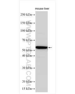 CYP4V2 Polyclonal antibody 13826-1-AP proteintech