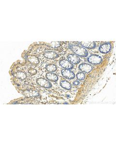 Talin-1 Polyclonal antibody 14168-1-AP proteintech