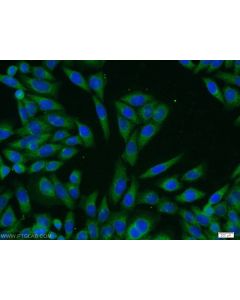 PASK Polyclonal antibody 14396-1-AP proteintech