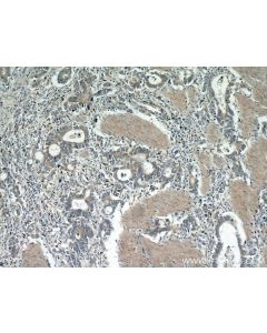Gastrokine 1 Polyclonal antibody 14494-1-AP proteintech