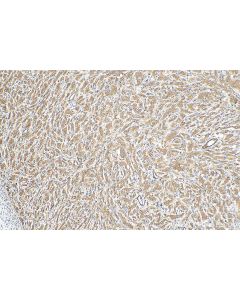 CARD8 Polyclonal antibody 14516-1-AP proteintech