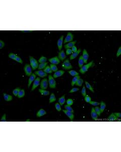 UBC12 Polyclonal antibody 14520-1-AP proteintech