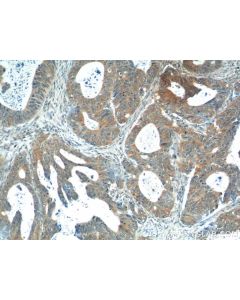 Calcipressin 1 Polyclonal antibody 14869-1-AP proteintech