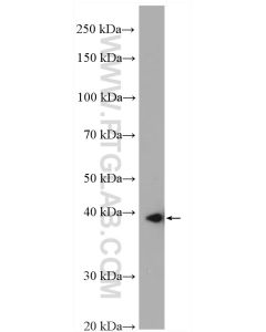 SLC25A39 Polyclonal antibody 14963-1-AP proteintech
