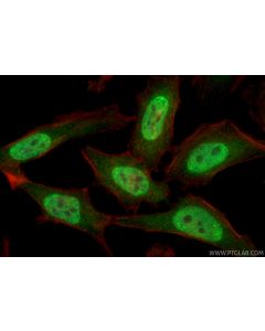 SNRPF Polyclonal antibody 14977-1-AP proteintech