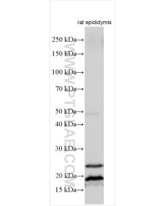 AP1S2 Polyclonal antibody 15043-1-AP proteintech