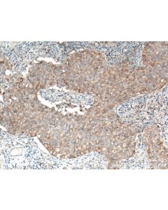 MAEA Polyclonal antibody 15238-1-AP proteintech