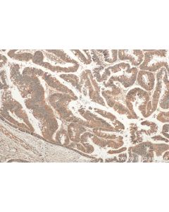AP3S2 Polyclonal antibody 15319-1-AP proteintech