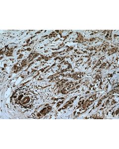 UBE2D1/2/3/4 Polyclonal antibody 15475-1-AP proteintech