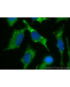 RNASEH1 Polyclonal antibody 15606-1-AP proteintech