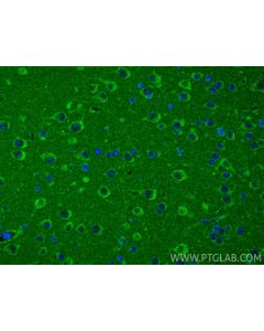 XPNPEP3 Polyclonal antibody 15655-1-AP proteintech