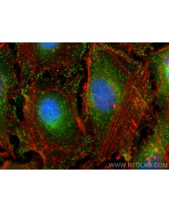 AP2B1 Polyclonal antibody 15690-1-AP proteintech