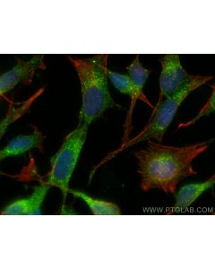 GRIPAP1 Polyclonal antibody 15806-1-AP proteintech