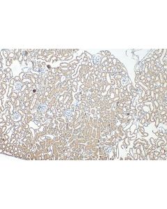Semenogelin-1 Polyclonal antibody 15916-1-AP proteintech