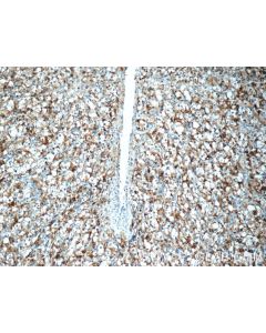 AMACR/p504S Polyclonal antibody 15918-1-AP proteintech