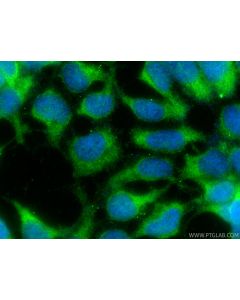 ALG5 Polyclonal antibody 16046-1-AP proteintech