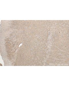 RAC1/2/3 Polyclonal antibody 16117-1-AP proteintech