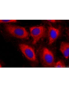ABI3 Polyclonal antibody 16227-1-AP proteintech