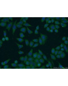 FN3KRP Polyclonal antibody 16312-1-AP proteintech