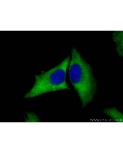 BTD Polyclonal antibody 16330-1-AP proteintech