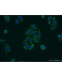 DNAJB5 Polyclonal antibody 16453-1-AP proteintech